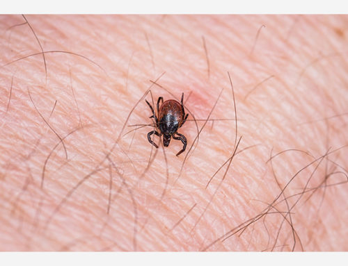 DYI Tips to Keep Ticks Out of Your Yard